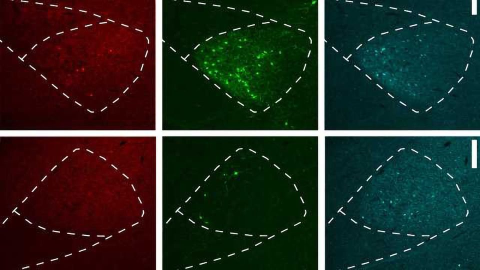 Overcoming Tropism in Retrograde Brain Cell Circuit Tracing content piece image