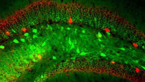Neuroscientists Reveal How the Hippocampus Makes Maps