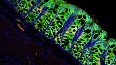 Stem-Cell Niche for 10 Billion Colon Cells a Day