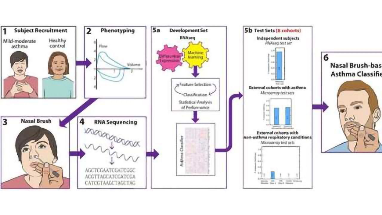 Nasal Brush Test to Diagnose Asthma