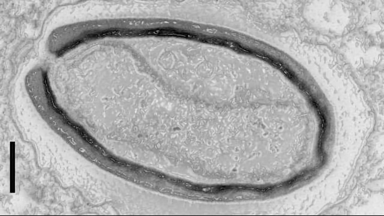 Giant Viruses Invent Their Own Genes