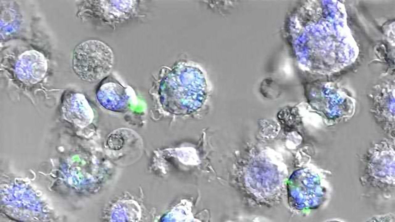 Vaccine Based on Spider Silk