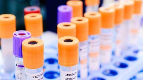Improved Method for Isolating Extracellular RNA