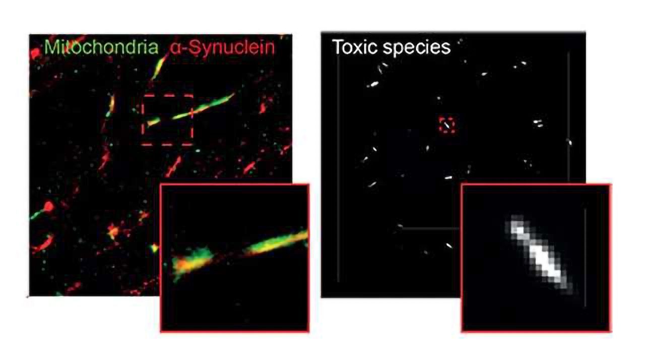 Mechanism by Which Alpha Synuclein Causes Cell Death in Parkinson's Identified