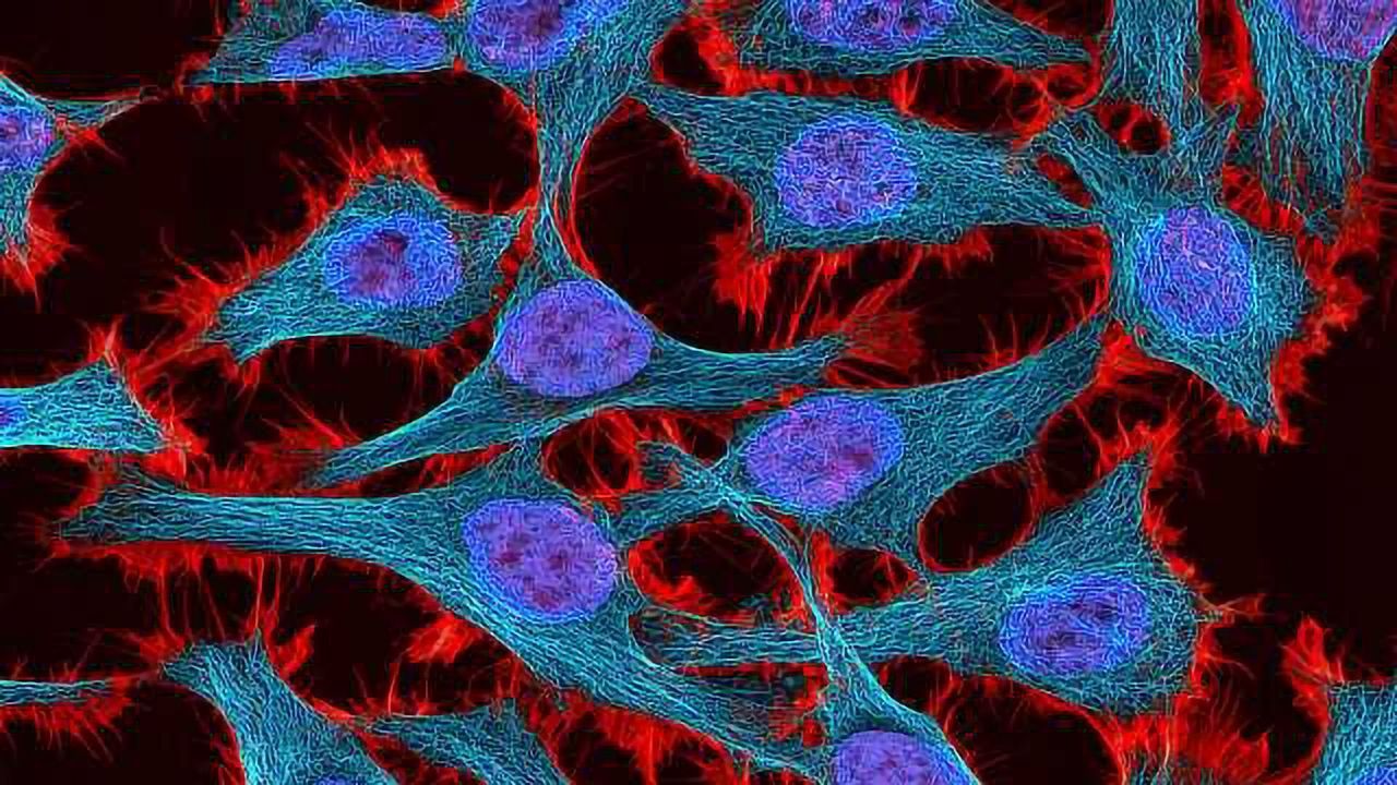 5 Contributions HeLa Cells Have Made to Science