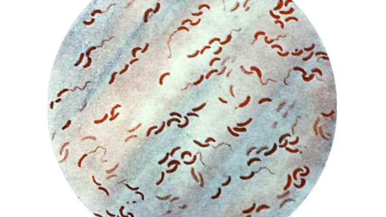 Recruiting Microbes to Combat Cholera Infection