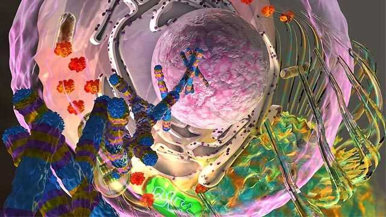 New Subtype of Prostate Cancer