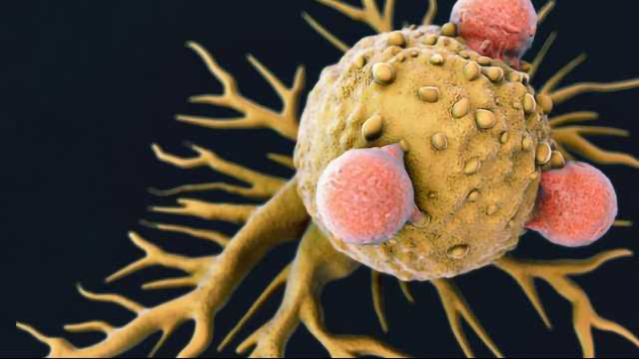 The Role of Wnt Signaling in Cancer