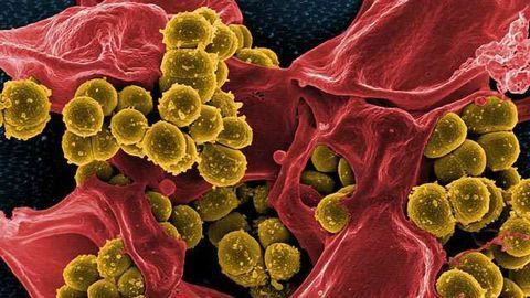 Compound as Effective as FDA-Approved Drugs Against Life-Threatening Infections