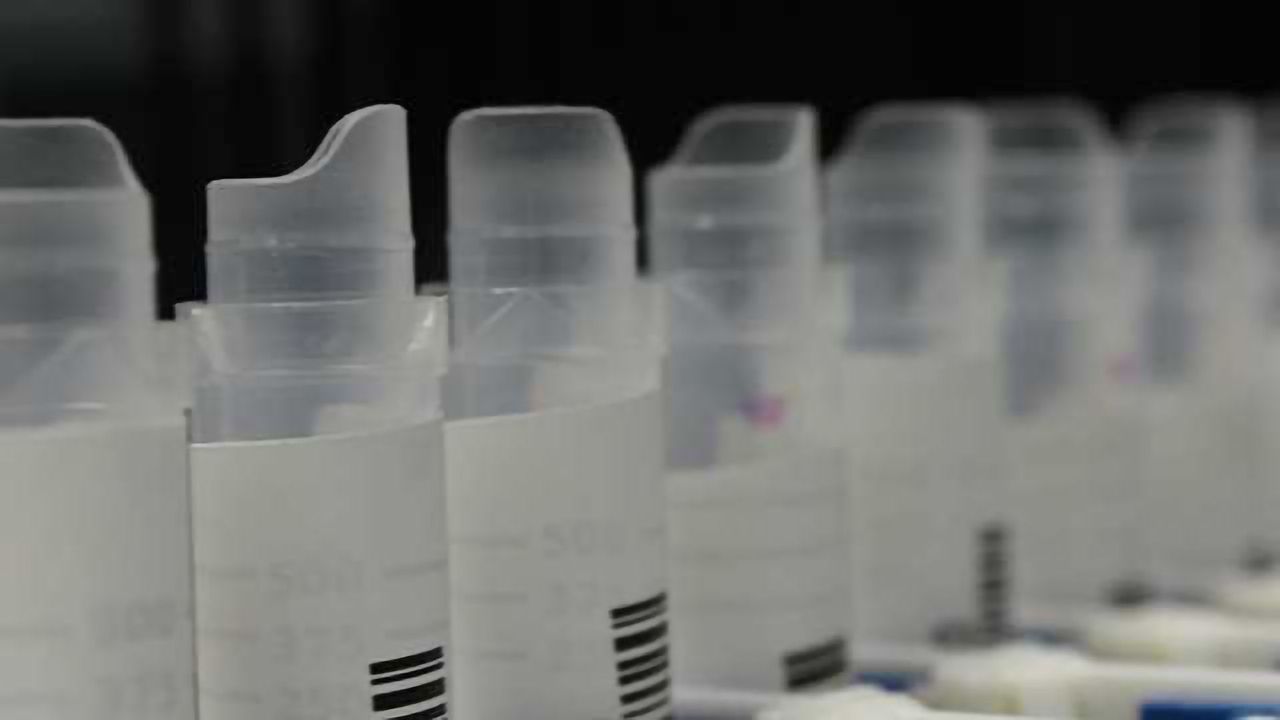 CIRCULOGENE’s Molecular Testing Can Potentially Improve Management of Advanced Ovarian Cancer Patients