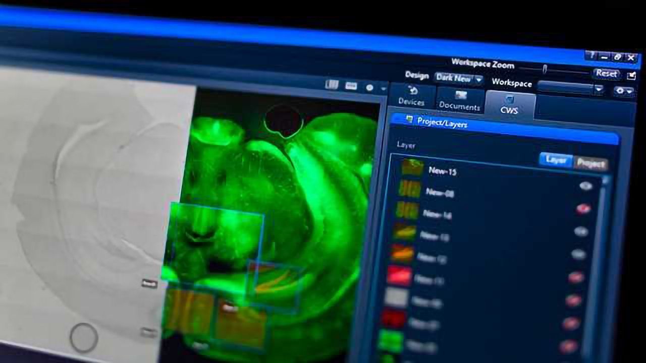 ZEISS Presents New Enhanced Software Technology