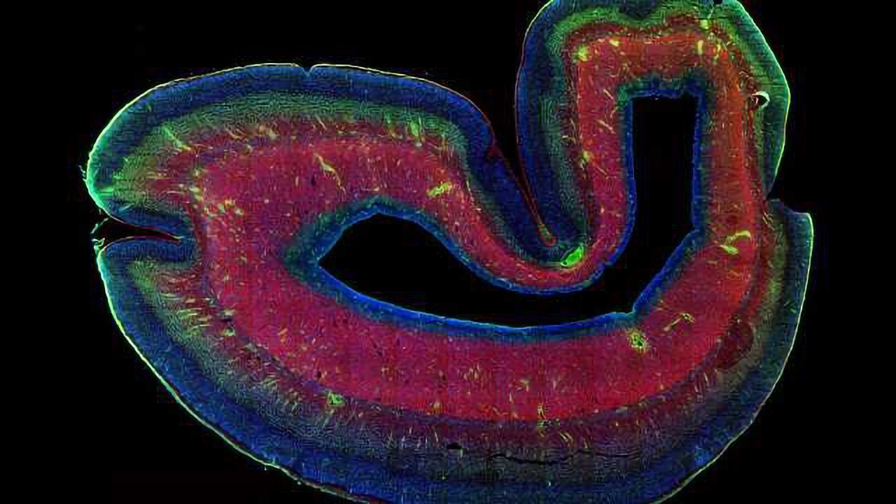 The Case of the Missing Brain Region is Solved