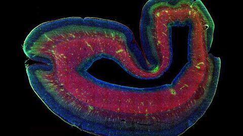 The Case of the Missing Brain Region is Solved