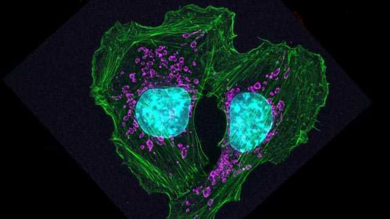 Discovery Advances Efforts to Prevent Spread of Cancer
