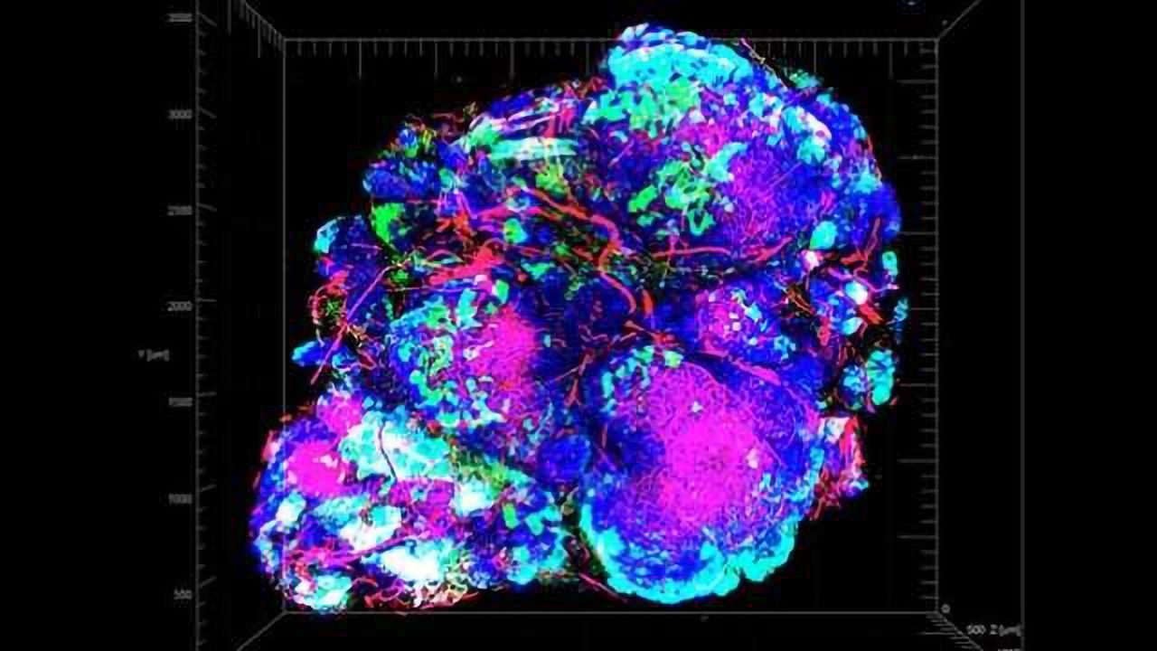 New Strategy for Starving Tumors