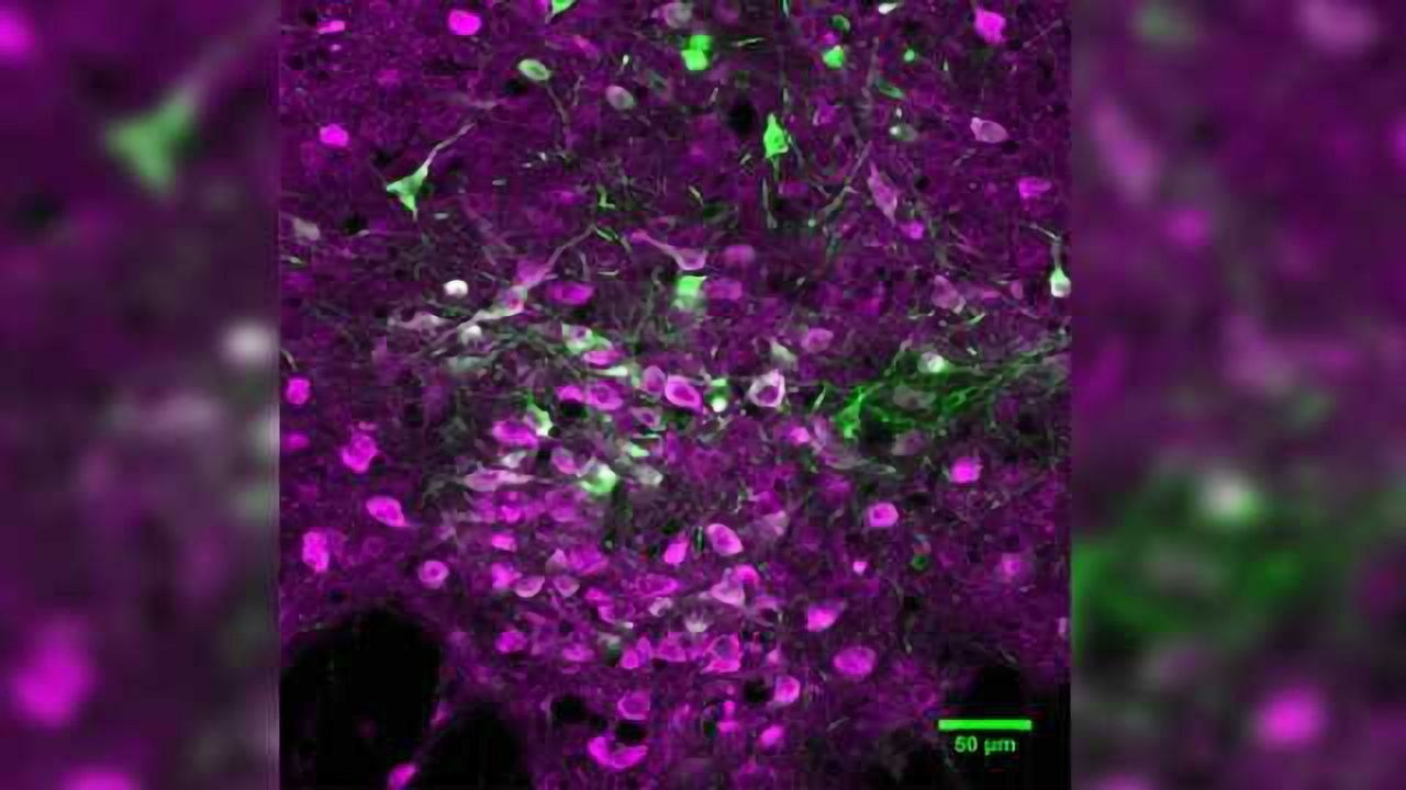 Win-Stay-Lose-Switch, Serotonin Speeds Rate of Long-term Learning