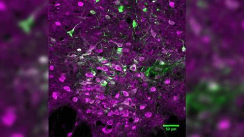 Win-Stay-Lose-Switch, Serotonin Speeds Rate of Long-term Learning