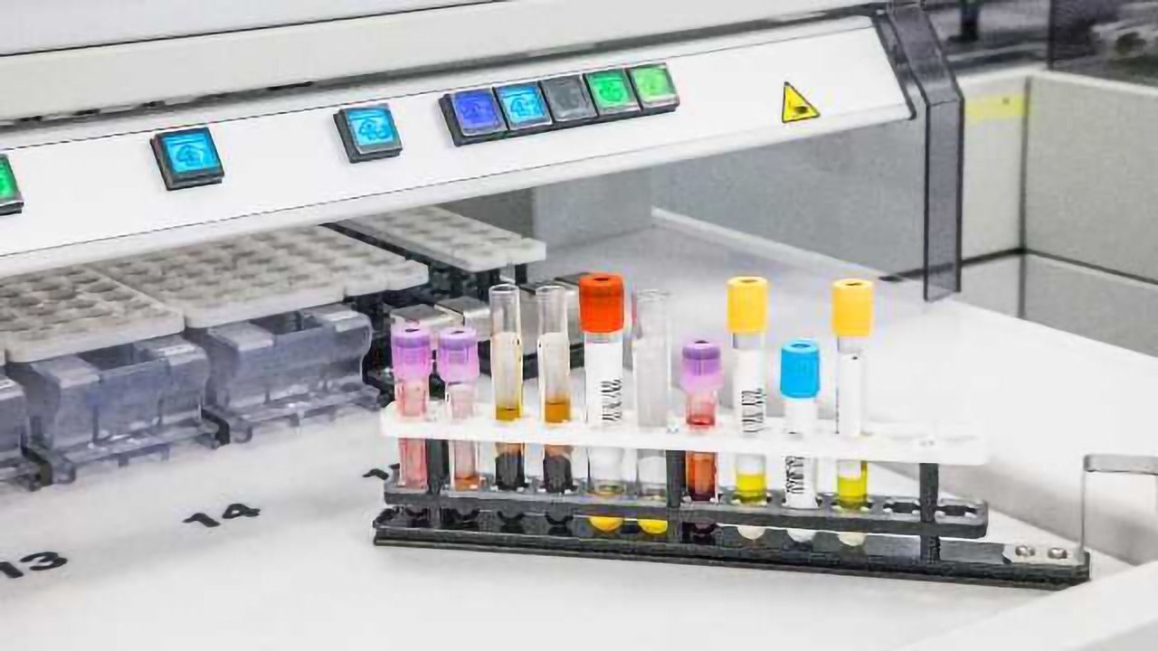 Metabolomics: The Long Journey from Lab to Clinic