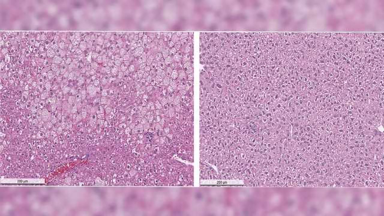 Promising Preclinical Results for Compound to Treat Wilson's Disease