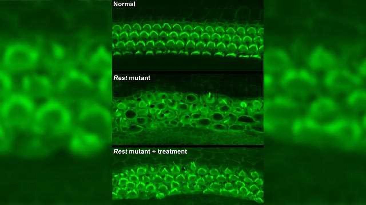 Novel Drug Partially Restores Hearing in Mice