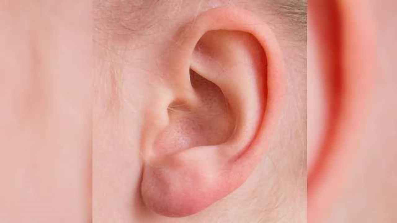 Inner Ear Pressure Release Valve Imaged in 3D