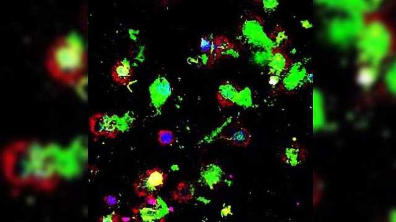 Eat 'Em Up: Therapeutic Helps Immune Cells Detect & Destroy Cancer