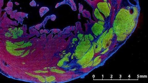 Stem Cells Restore Function in Primate Heart-failure Study