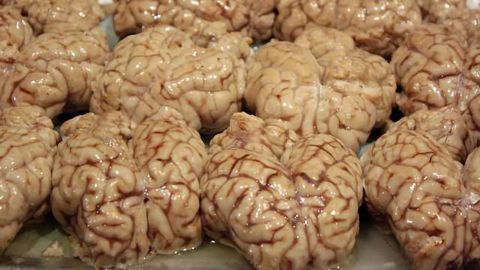 Experimental Drug Stops Parkinson’s Disease Progression in Mice
