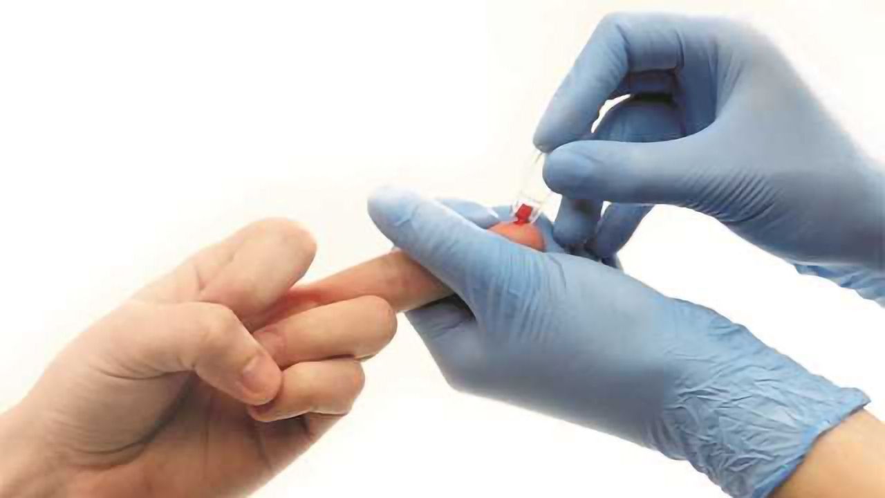 EKF Publishes Guide to Good Capillary Blood Sampling