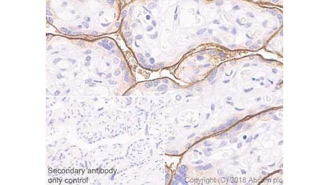 Abcam Merck Collaboration Produces New PD-L1 Antibody for Immuno-Oncology Research  content piece image 