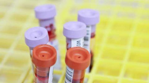 Sound Waves Could Provide 'Liquid Biopsies'