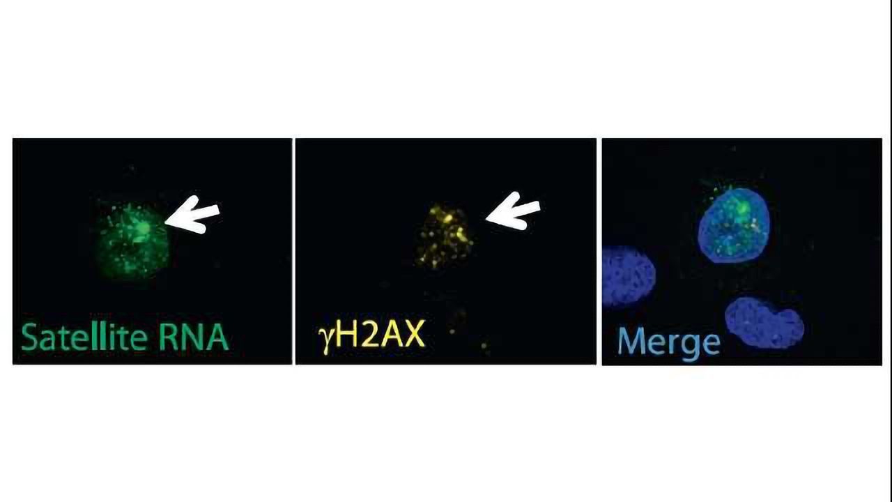 Cellular Satellites Could Be Breast Cancer Target