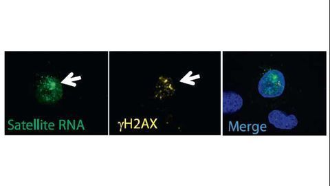 Cellular Satellites Could Be Breast Cancer Target