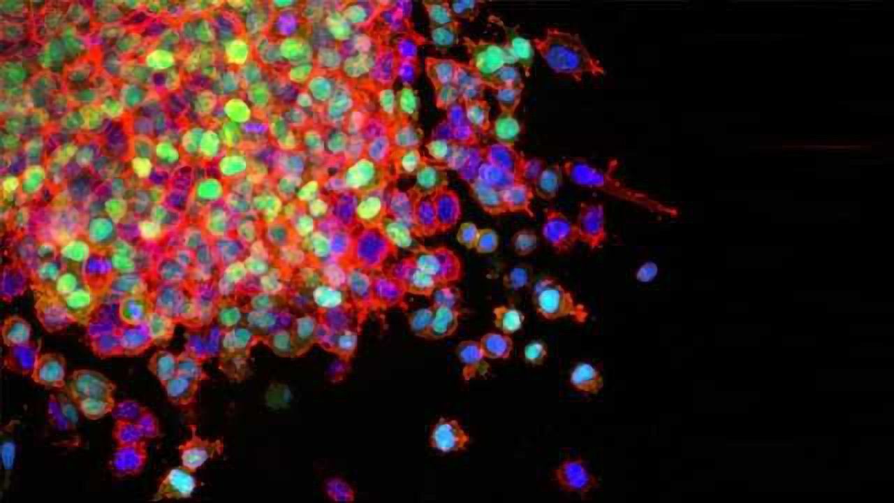Targeting Vulnerability in Deadly Form of Lung Cancer
