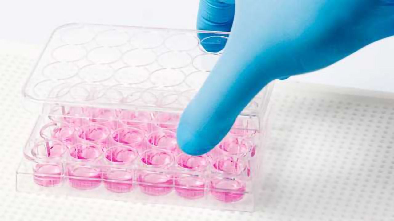 Cell Culture Quality Control: Blissful Ignorance?