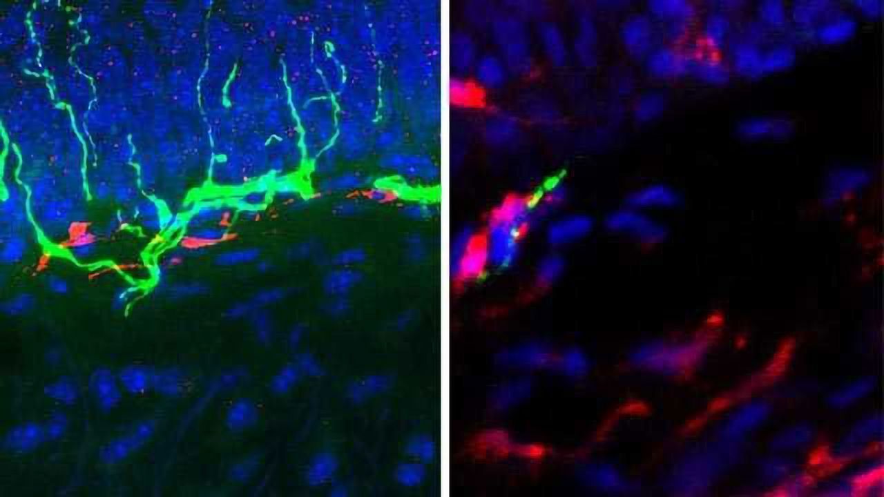 Non-Opioid Investigational Drug Shows Promise as a Treatment for Lingering Nerve Pain