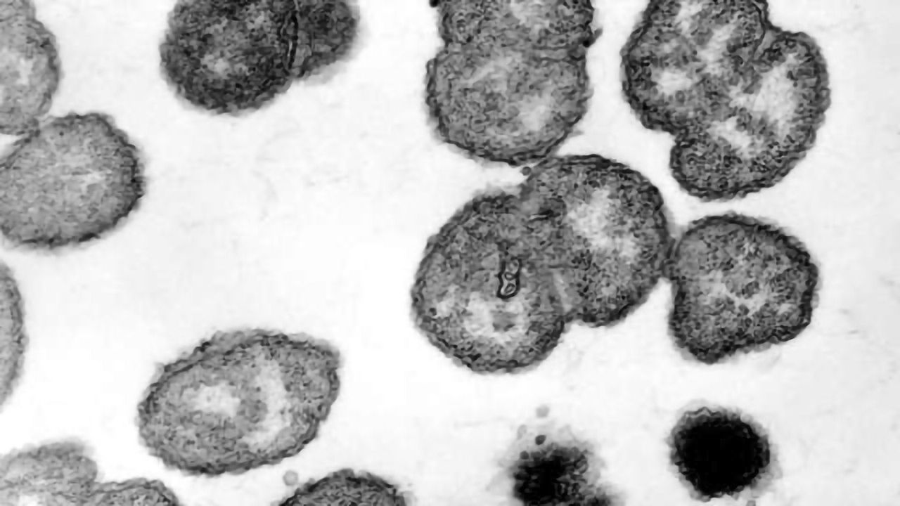 Gonorrhea: New Target for Antibiotics and Vaccines