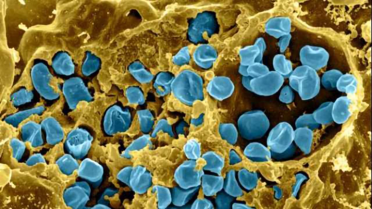 Natural Lipid Molecule is a Potent Anti-Inflammatory