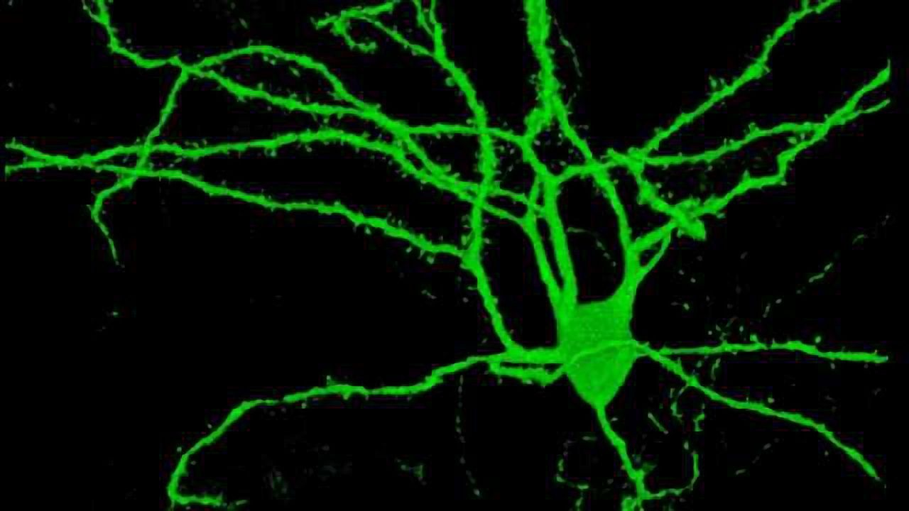 Single-Cell Sequencing Helps Understand Spiny Neurons