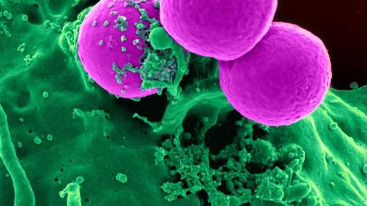 Boost The Immune System to Protect the Brain From Alzheimer's