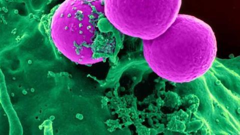 Boost The Immune System to Protect the Brain From Alzheimer's