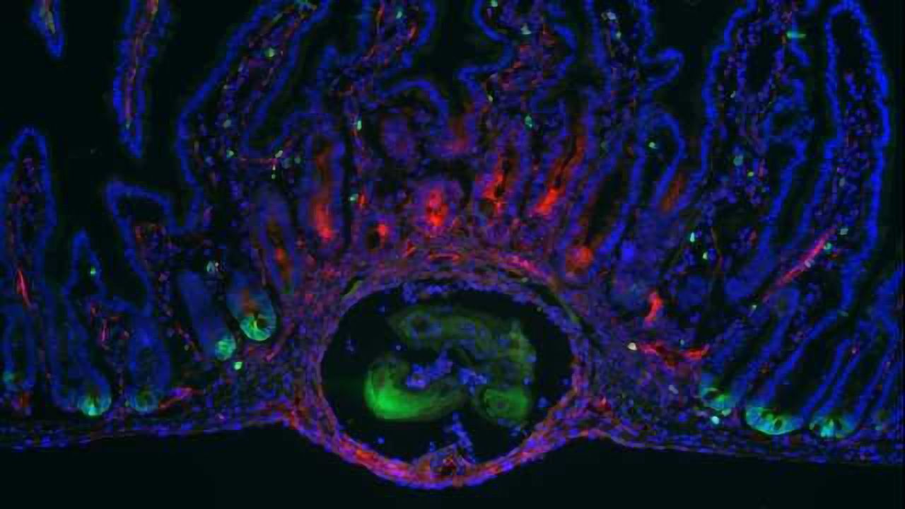 Parasite Reveals Unseen Form of Gut Healing