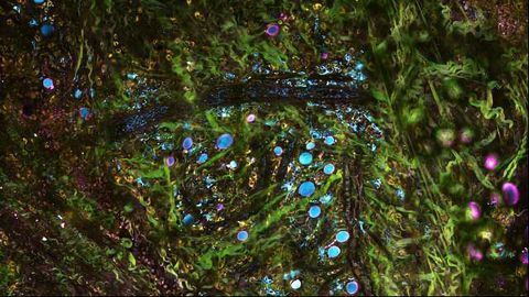 New Tissue-imaging Technology Could Enable Real-time Diagnostics