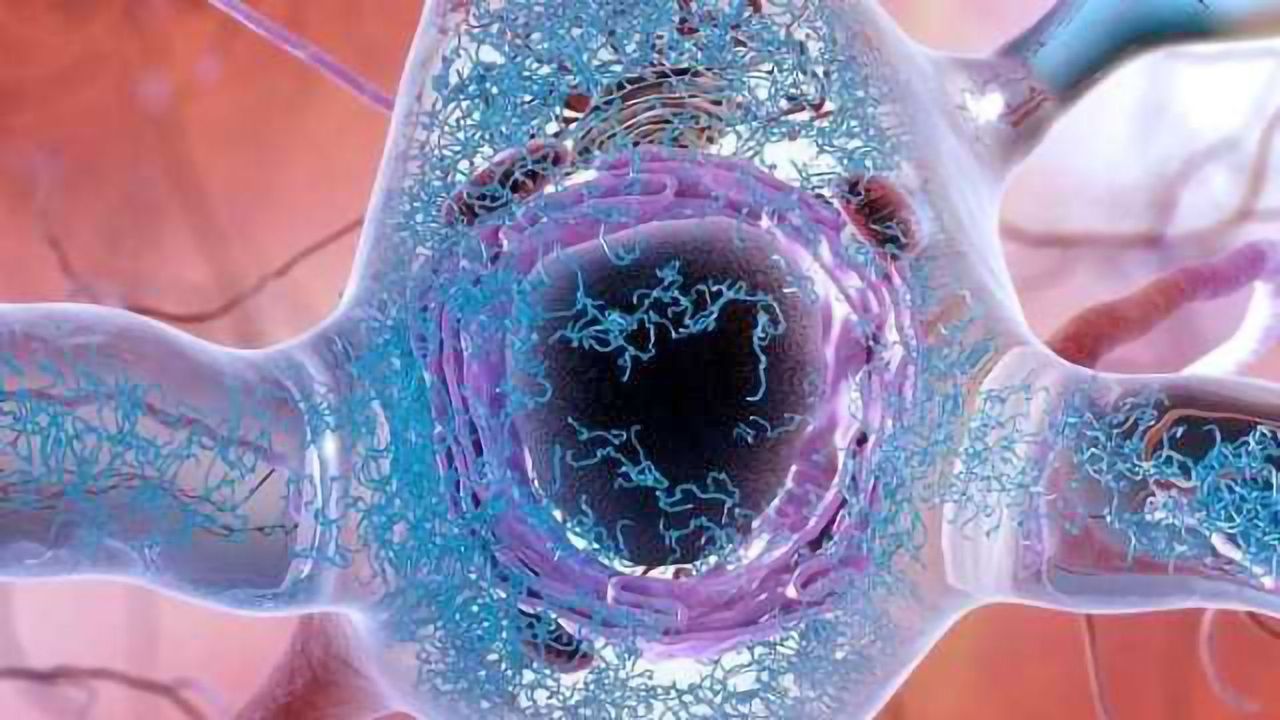 Scientists ID Genesis of Toxic Proteins Behind Alzheimer's Disease