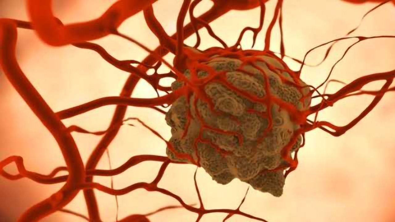American Cancer Society Outlines New Blueprint for Cancer Control