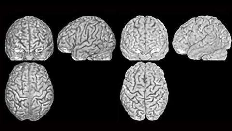 Brain Structure as Unique as a Fingerprint