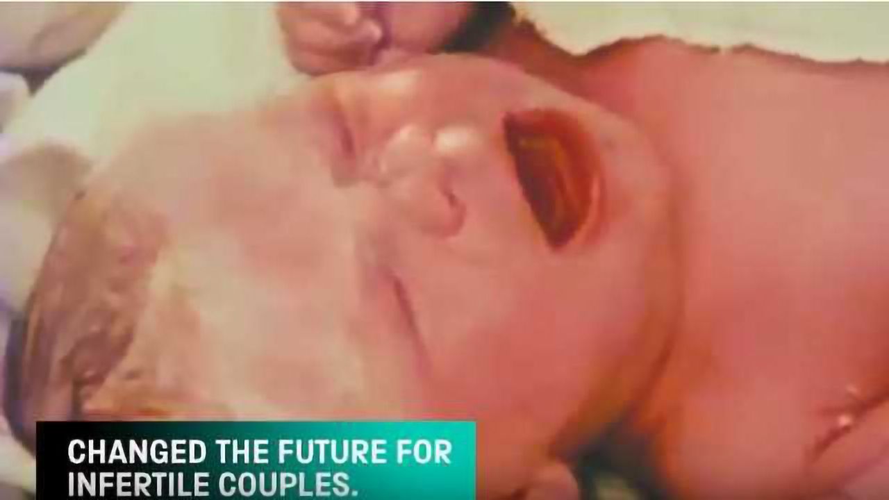 The First IVF Baby