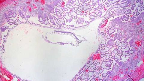 Marks to Prove It: Scientists Observe the Earliest Days of Our Epigenome