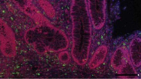 Novel Therapeutic Targets for Tumors Associated with Chronic Inflammation