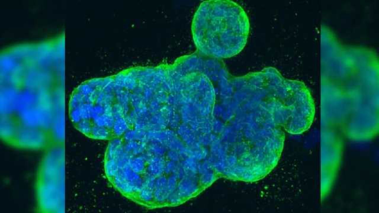 New Approach Sheds Light on the Effects of Anti-Cancer Drugs